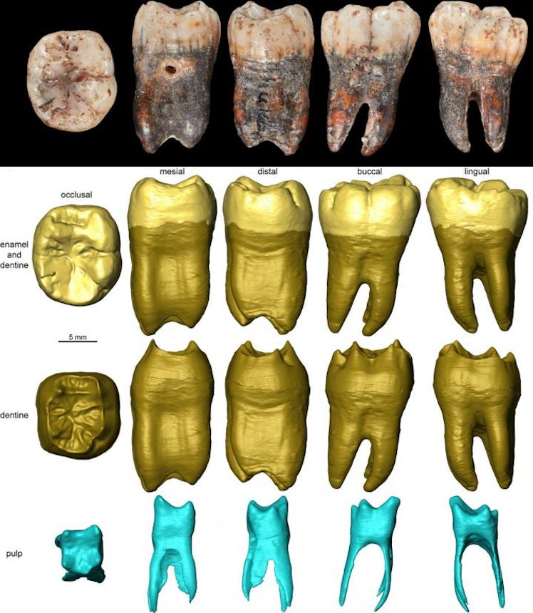 3D Neanderthal tooth