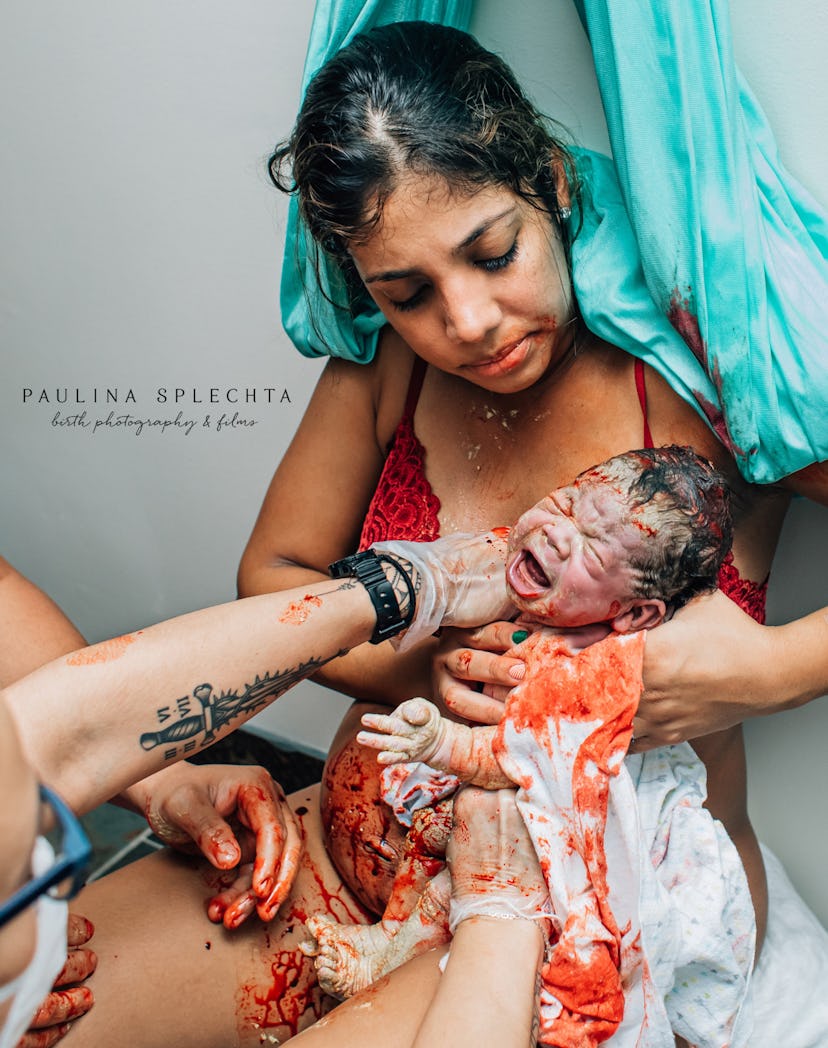 Gloved hands hand a woman a newborn child moments after its birth.