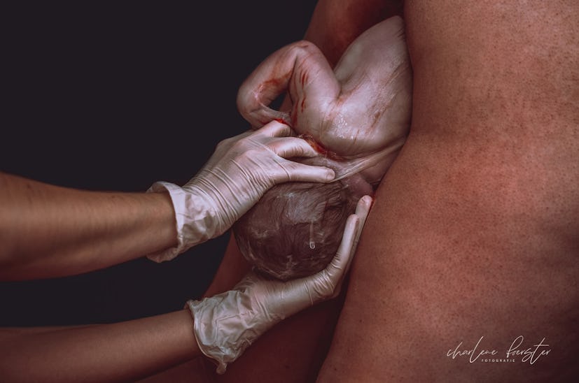 Two gloved hands guide a newborn into the world.