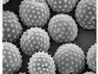 Scanning electron microscopy image of ragweed pollen.