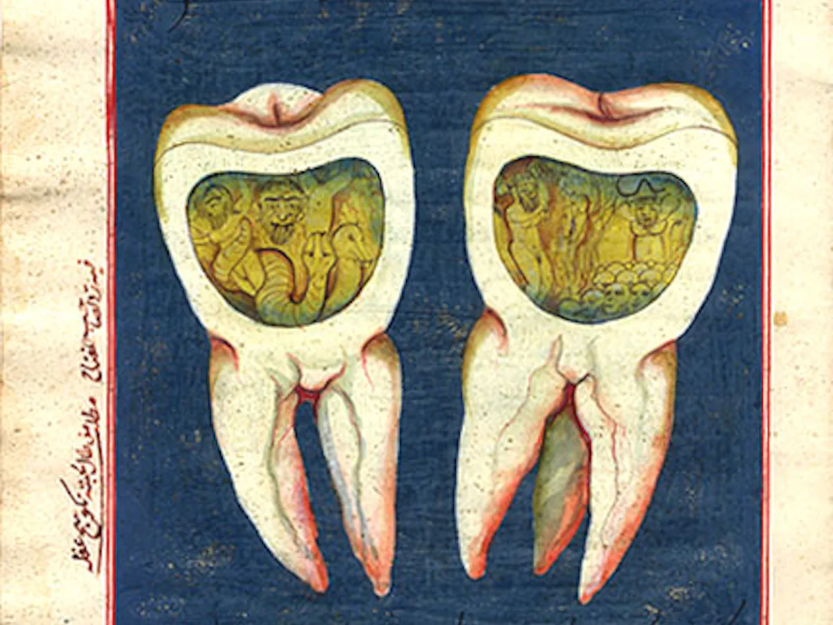 Antique illustration of molar teeth with miniature scenes inside pulp cavities illustrating historical beliefs
