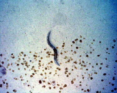 roundworms, C. elegans