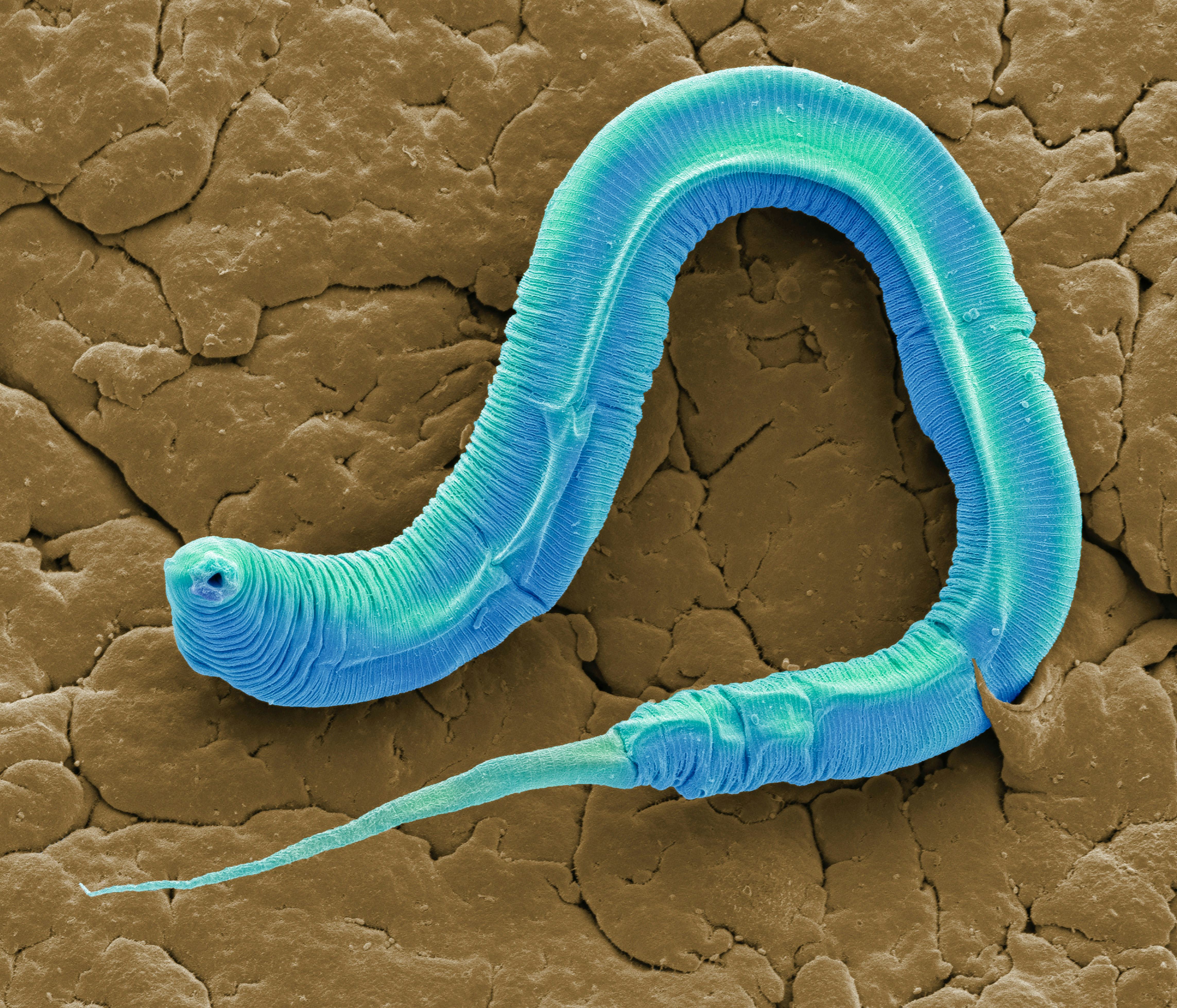 An eyeless worm has upended scientific understanding of color