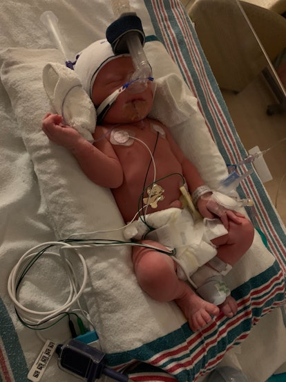 Our son was in the NICU for a few days as his lungs continued to develop.