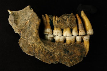 Neanderthal teeth; close-up