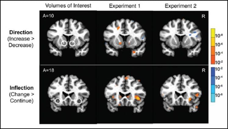 Brain scans of six study participants