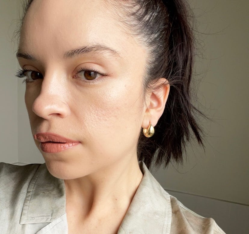 medical grade peel