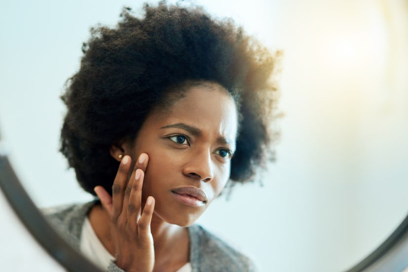 Black woman with Rosacea looking at her face skin in the mirror