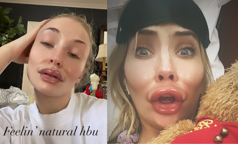 Here's How To Get The "Pillow Face" Filter On Instagram For A Wild