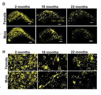 Imaging in mouse brain shows less neural progenitor cells in aging males vs. females