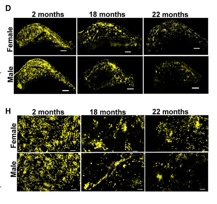 Imaging in mouse brain shows less neural progenitor cells in aging males vs. females