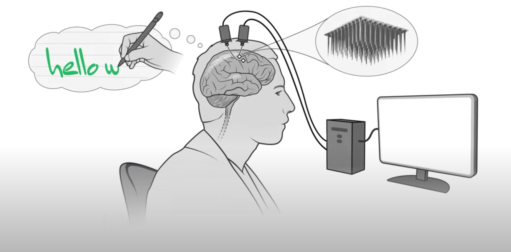 A new brain-computer interface could allow people with physical impairments to type on a computer us...