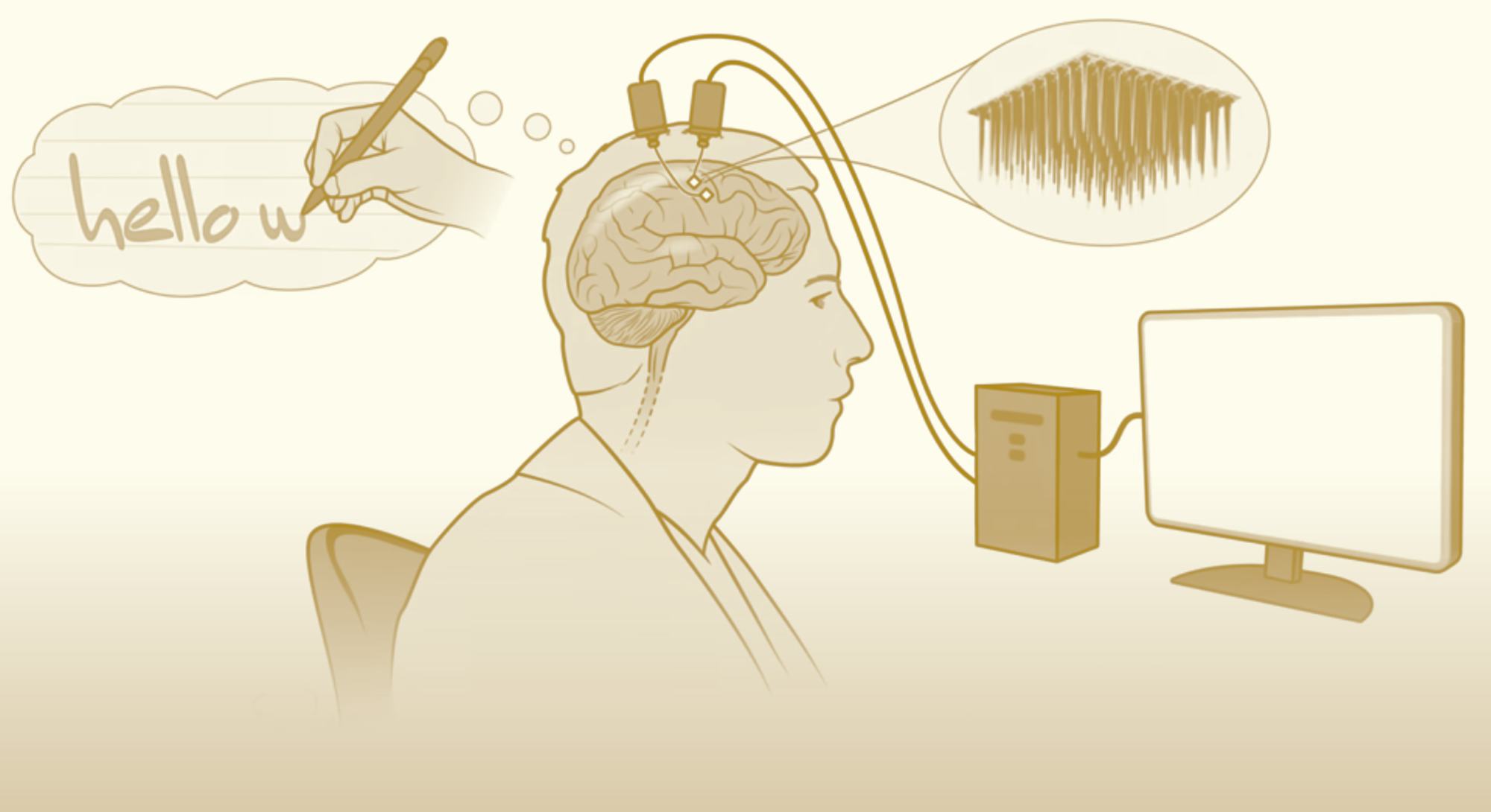 A new brain-computer interface could allow people with physical impairments to type on a computer us...