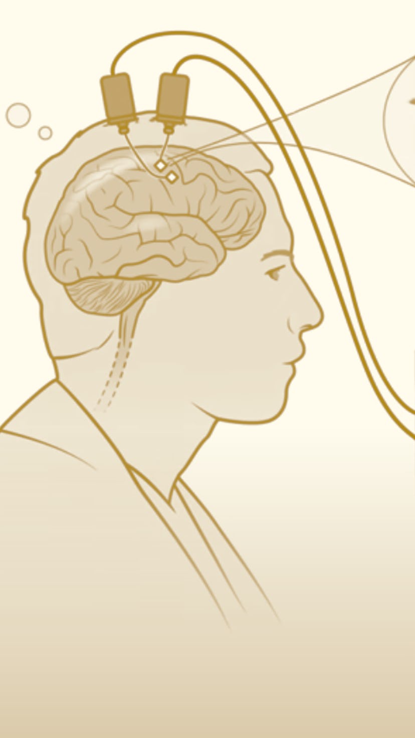 A new brain-computer interface could allow people with physical impairments to type on a computer us...