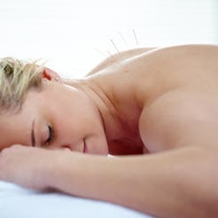 What happened when I tried acupuncture to ease endometriosis pain.