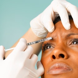 Woman getting a needle injection in forehead