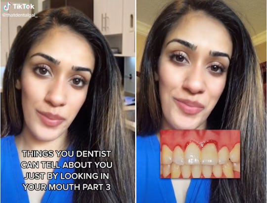 Viral Tiktok Explains How Dentists Can Tell If You Re Pregnant