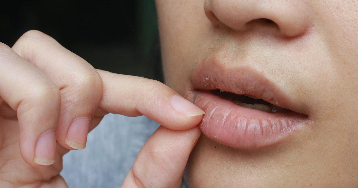 How To Stop Picking Your Lips, Straight From An Expert