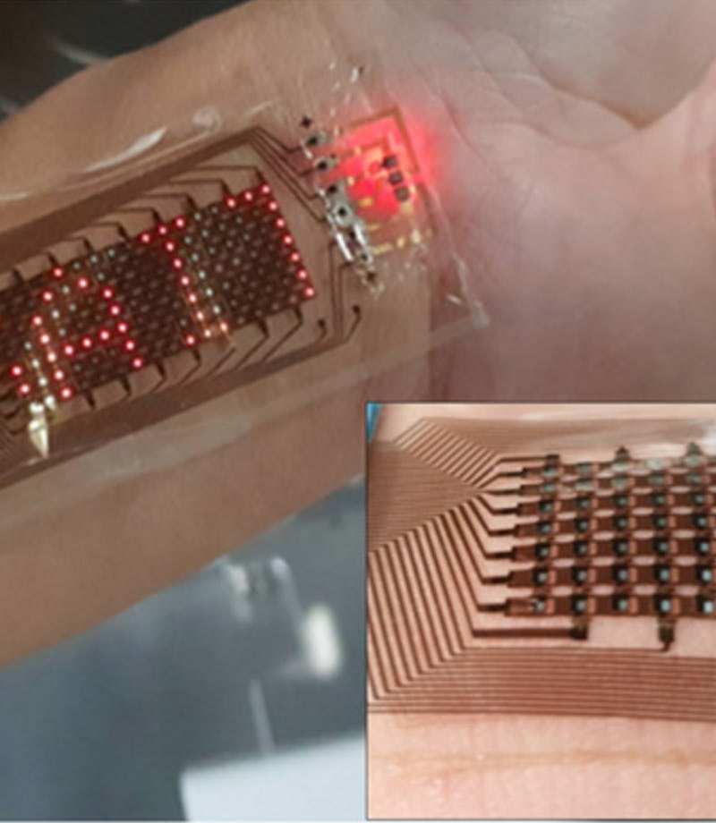 A stretchable screen made by Samsung. Foldable. Display. Technology. Wearables. Medtech.