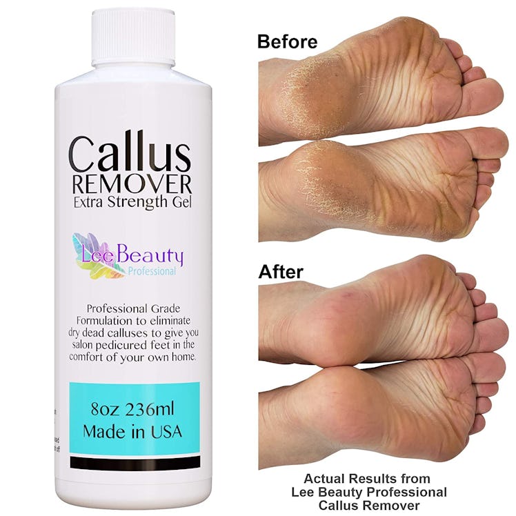 Lee Beauty Callus Remover Gel