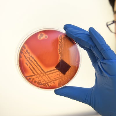 Jean Lee, a PhD student at Melbourne's Doherty Institute, inspects the superbug Staphylcocus epiderm...