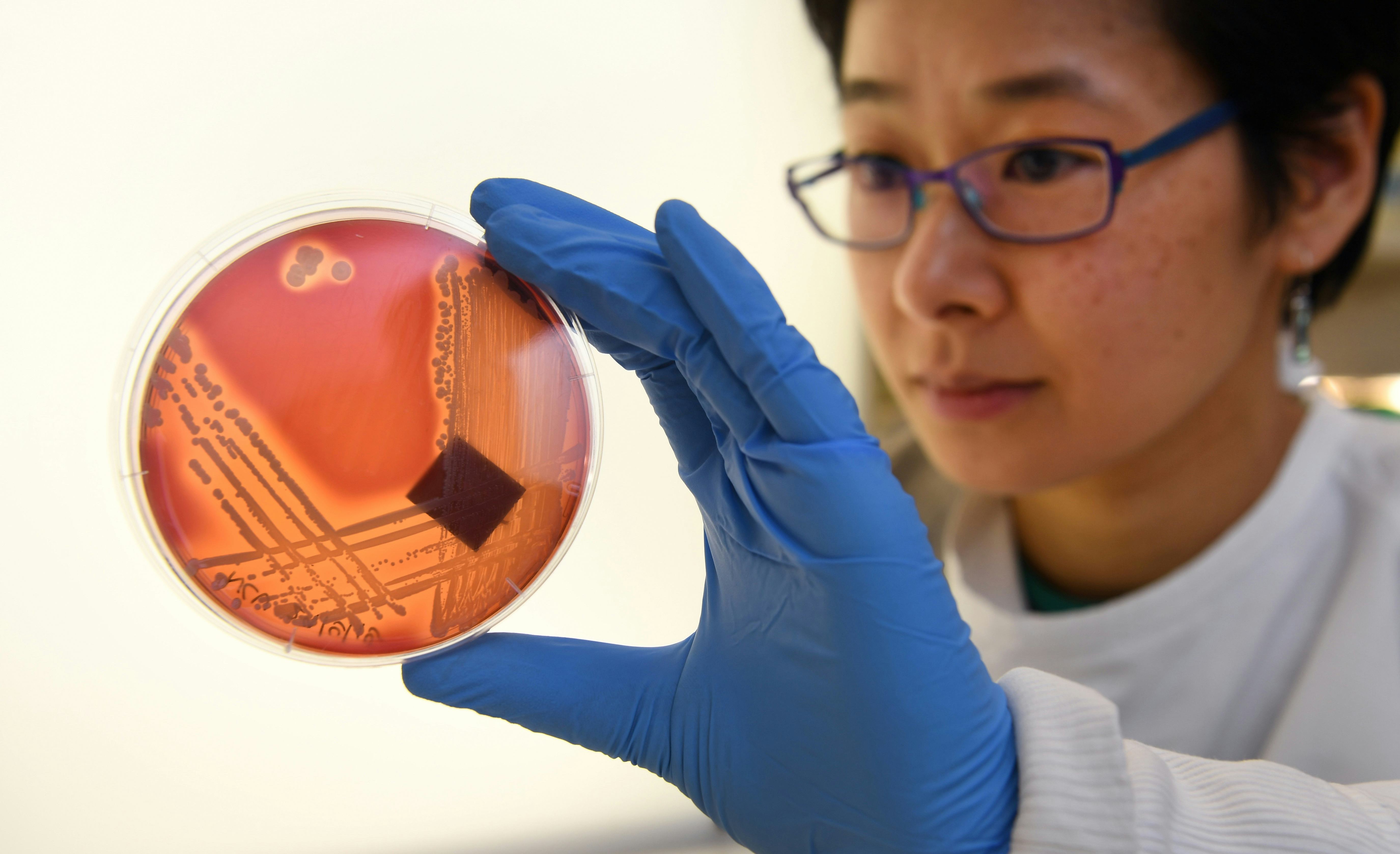 The next pandemic could come from antibioticresistant bacteria