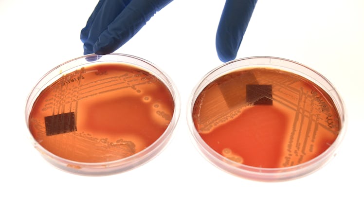 superbug Staphylcocus epidermidis