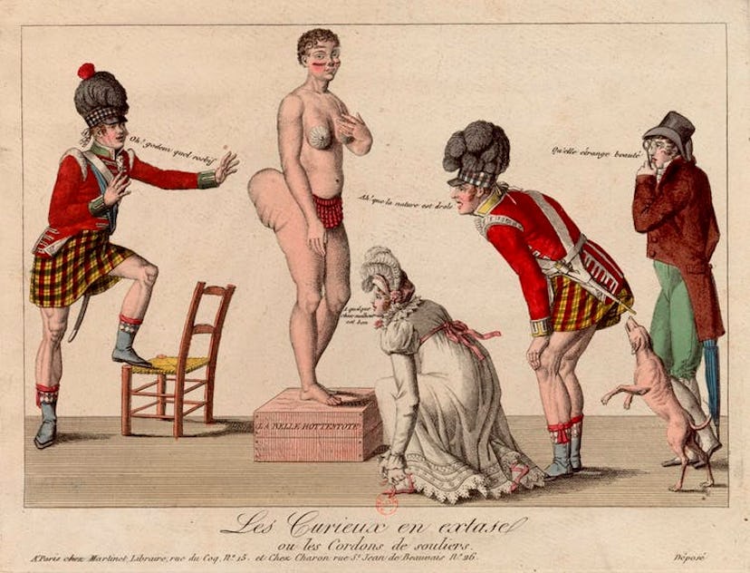 Baartman had a naturally occurring condition called ‘steatopygia.’ 