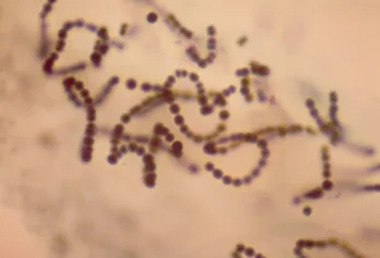 cyanobacteria