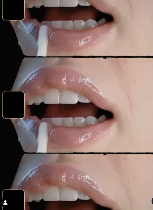 Dr. Lara Devgan Platinum Lip Plump