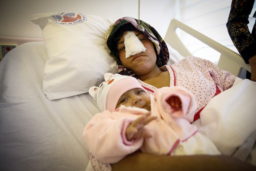 Reza Gul, 22, whose nose was cut off by her husband in Faryab Province of Afghanistan, holds her thr...