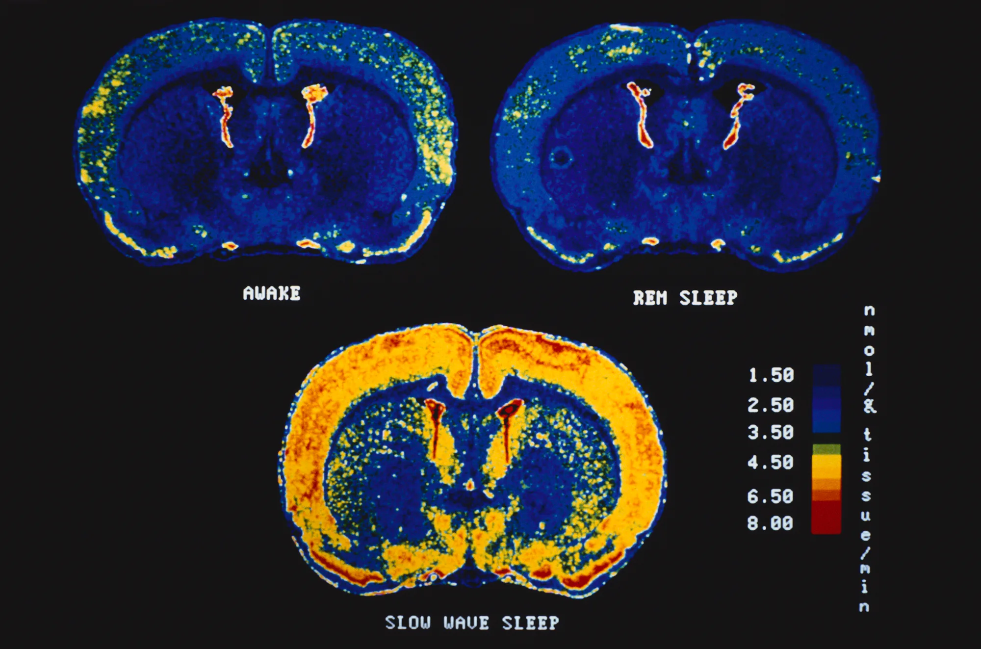How to sleep better: 5 hacks for more rest and less stress