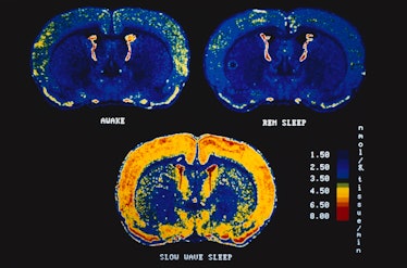 Sleep, brain scans