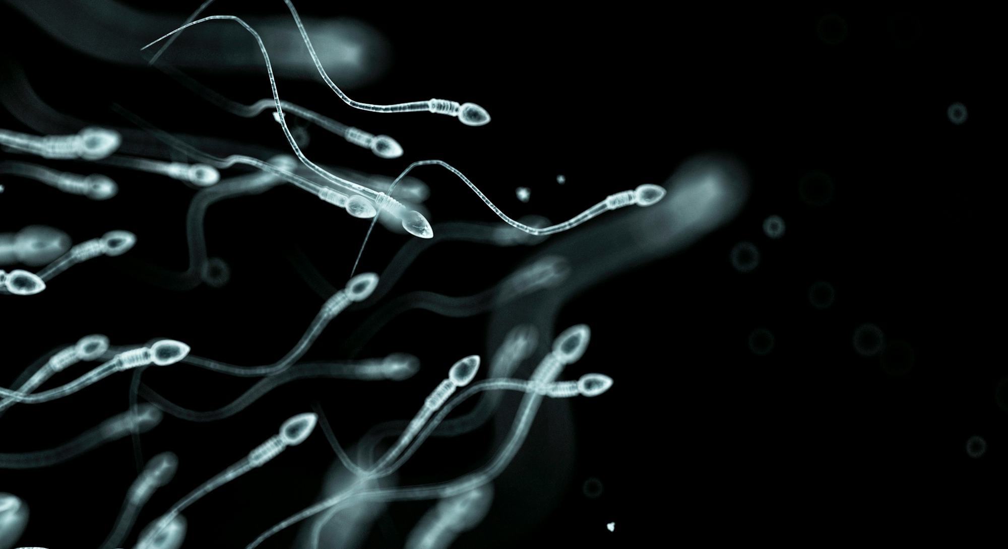 Sperm