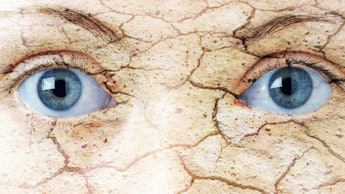 A closeup of a person's eye-area with cracked skin representing the effects climate change can have ...