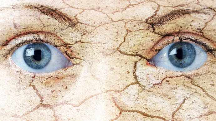 A closeup of a person's eye-area with cracked skin representing the effects climate change can have ...