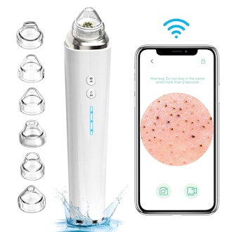 prabensei Blackhead Remover Vacuum