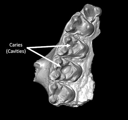 Part of the upper jaw from Microsyops latidens with two caries (cavities).