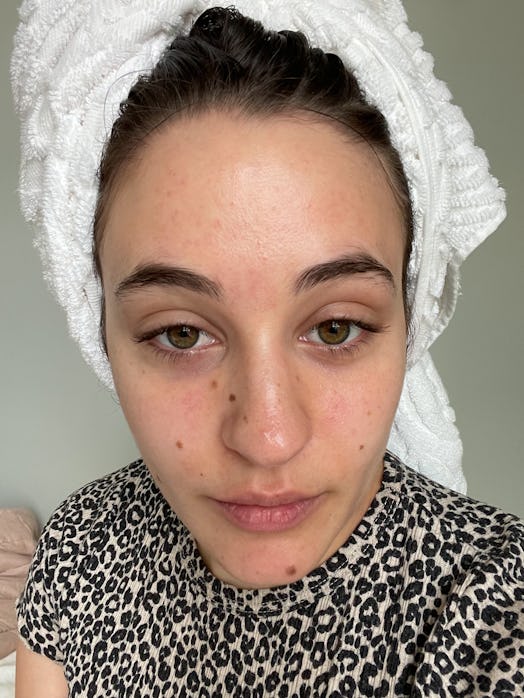 Isabella's skin before using the Tatcha Texture Tonic