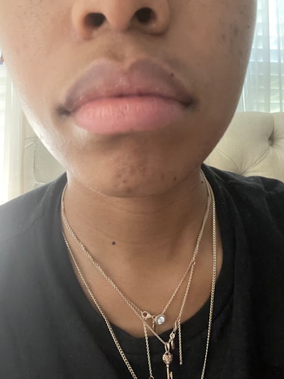 Filled lips of a young woman