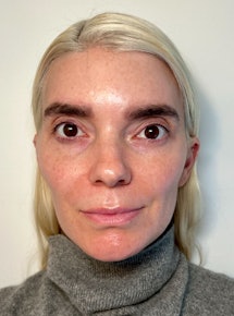 A woman before she used Talika Lopcils mascara 