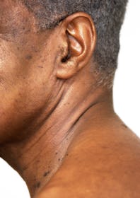 Close up on a man's ear hair.