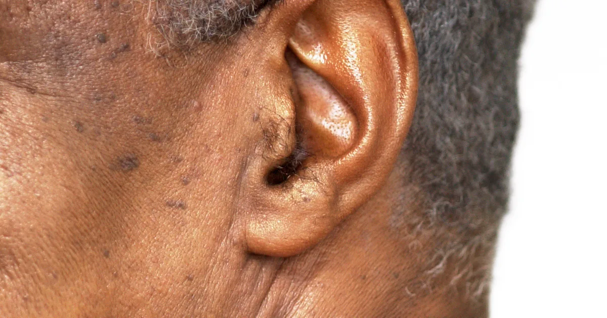 How To Deal With Ear Hair Once And For All