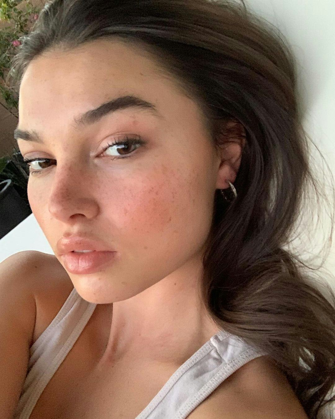 Your skin cycling for acne guide, straight from derms.