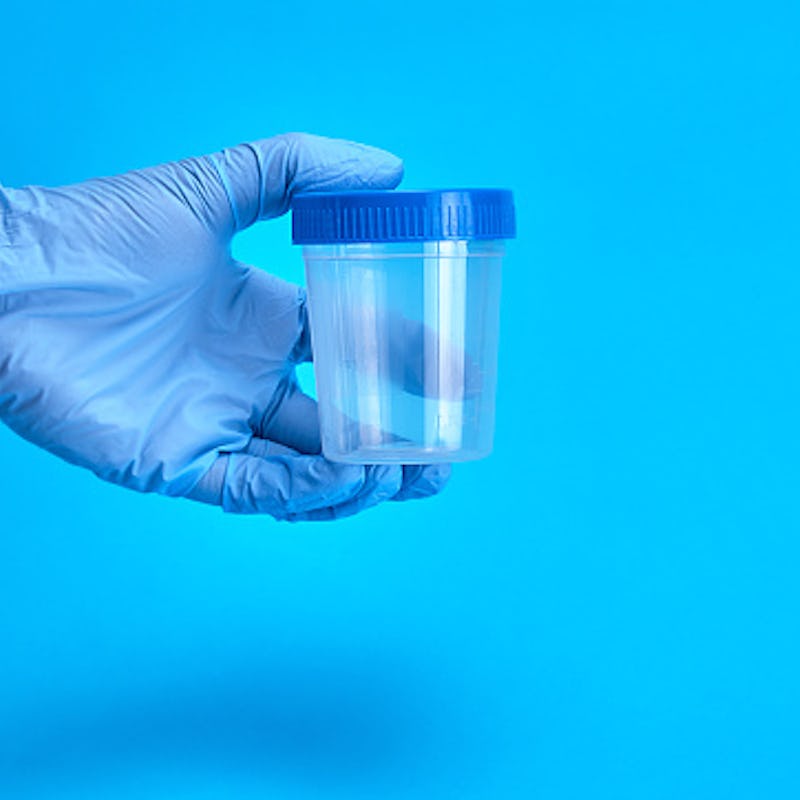 Empty Urine Cup