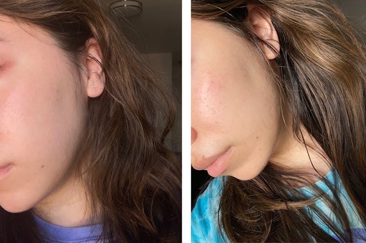 Beauty writer Madison San Miguel's face before and after slugging