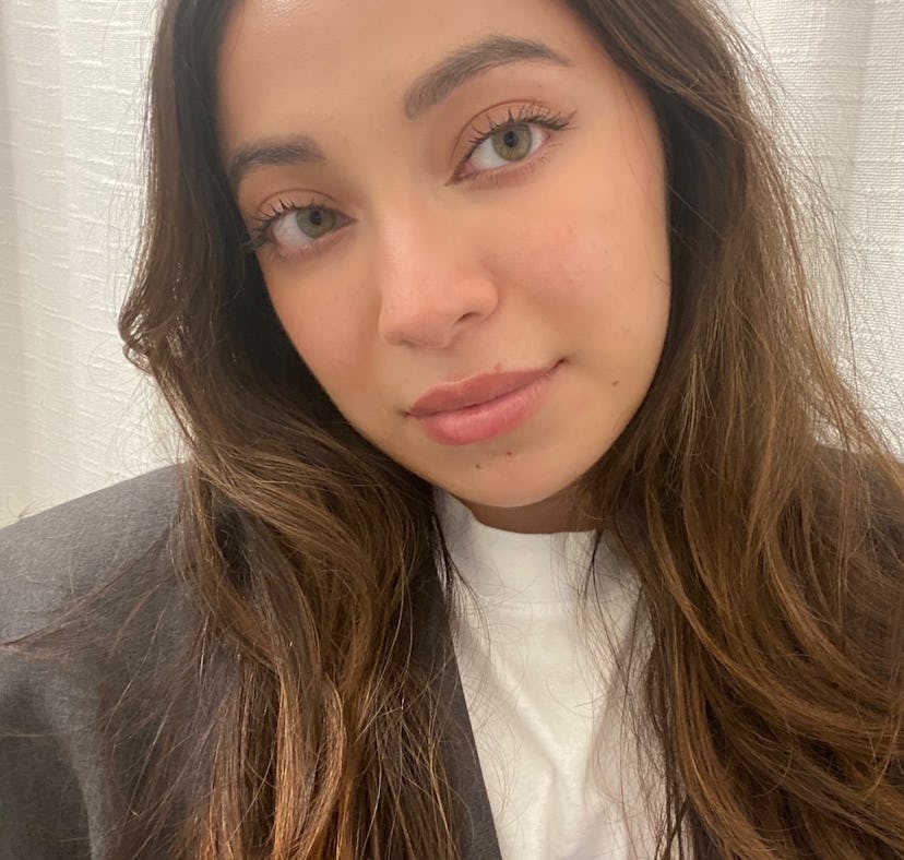 Madison San Miguel after trying skin cycling on her dry, acne prone skin.