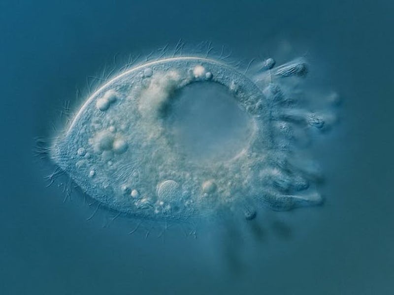 Legendrea loyezae, a very rare ciliate that lives in oxygen-free sediments of lakes.