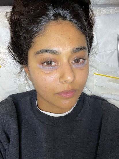 Woman getting a lower lash lift done