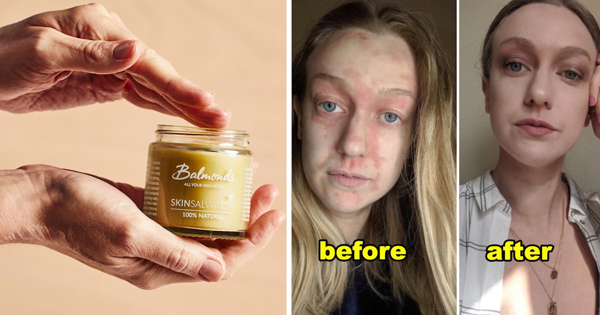This Soothing, Plant-Based Skin Balm Is Loved By Celebs & Makeup Artists — And It’ll Be 50% Off On Black Friday This Soothing, Plant-Based Skin Balm Is Loved By Celebs & Makeup Artists — And It’ll Be 50% Off On Black Friday